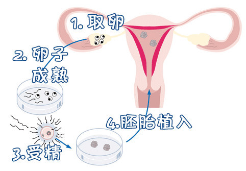 手术室